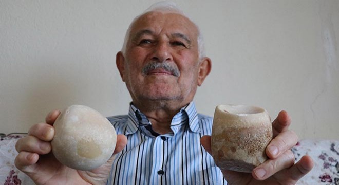 Mesanesinden 2,5 kilo taş çıktı